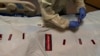 CDC: COVID-19 Third Leading Cause of Death Again in US in 2021