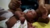 Gustavo Henrique who is 2-months old and born with microcephaly, reacts to stimulus during an evaluation session with a physiotherapist at the Altino Ventura rehabilitation center in Recife, Brazil, Feb. 11, 2016. 