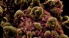 Imagen de partículas del virus SARS-COV-2. [Foto: Archivo]