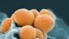 L'OMS liste 12 "superbactéries" contre lesquelles il faut de nouveaux antibiotiques