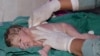 FILES - In this file photo taken on May 12, 2016 a Pakistani doctor cleans a newborn baby after his birth at a hospital in Muzaffarabad.