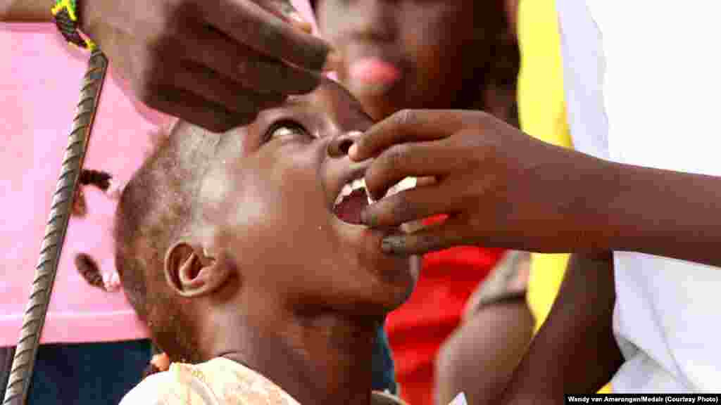 Un enfant se fait administrer un vaccin oral contre le choléra au camp de dépllacés à Juba, dans le Sud Soudan. Une mauvaise hygiène des mains est l'une des causes du choléra qui fait rage dans beaucoup de pays d'Afrique.