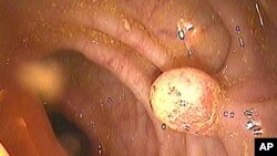 Test de cancer colorectal