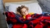 Surgeons are struggling to save the leg of three-year-old Noor after an airstrike injured her two weeks ago as the Mosul offensive started. “I want to see it, I want to see what happened to me,” she told her aunt. (J. Dettmer/VOA)