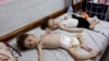 Palestinian children Uday, left, and Mohammed Mahra, both suffering from malnutrition, rest at the Kamal Adwan hospital in Beit Lahia in the northern Gaza Strip on July 9, 2024.