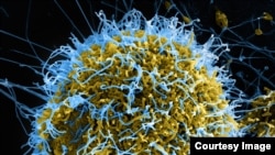 Les symptômes du virus de Lassa sont similaires à ceux du virus à Ebola (NIAID)