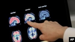FILE - Dr. William Burke goes over a PET brain scan, Aug. 14, 2018 at Banner Alzheimers Institute in Phoenix, Arizona.