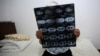 A Mongolian woman holds up her CT scan film in a hospital in Beijing, June 22, 2016. The woman was being treated for rectal cancer.