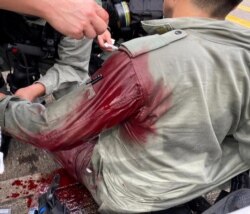 在香港主權移交中國紀念日當天港人遊行反對港版國安法期間一名港警受傷。（2020年7月1日）