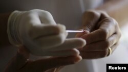 
Une infirmière prépare un test d'urgence pour diagnostiquer la dengue dans une unité de soins médicaux de la dengue dans le quartier Sao Sebastiao de Brasilia, au Brésil, le 19 février 2016.