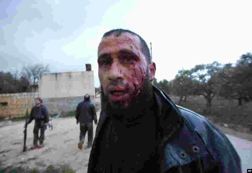 A Syrian rebel retreats for medical treatment in Idlib, February 8, 2012. (AP)